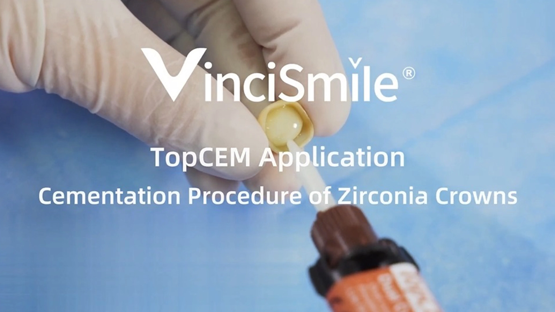 Vinci Smile TopCEM Indirekte Restaurierung-Zementierung von Zirkonia Kronen