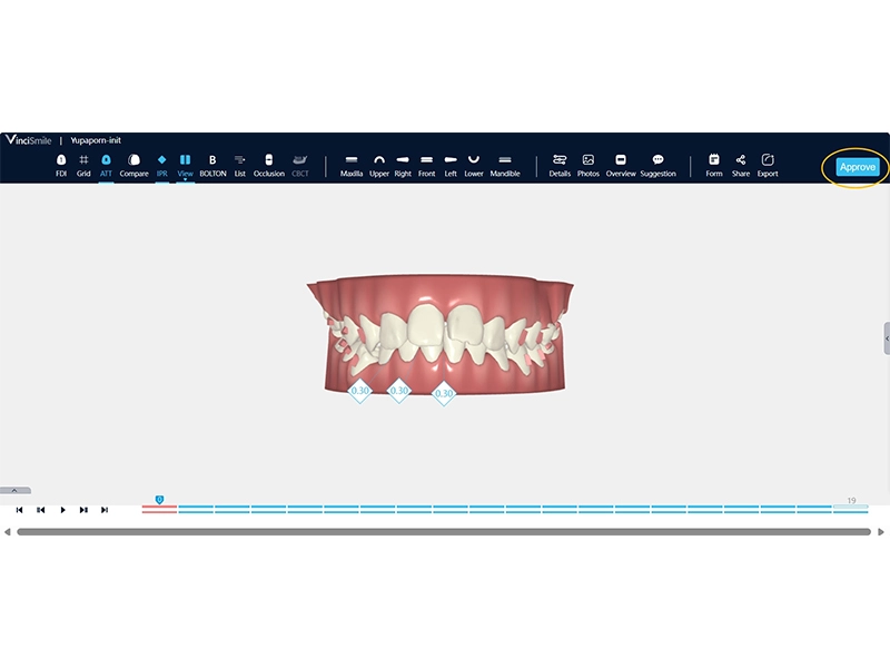 3. Genehmigen Sie das 3D-Schema